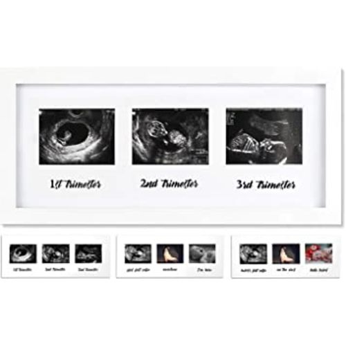 IHEIPYE Triple Sonogram Pregnancy Frame - Baby Ultrasound Picture Frame for Expecting Parents, Baby Shower Frame, Gender Reveal Party, Baby Nursery Decor, White
