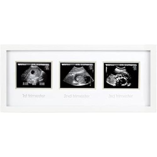 Pearhead Sonogram Progression Frame - Trimester by Trimester Pregnancy Milestone Keepsake, Gender-Neutral Nursery Decor, Displays 1st, 2nd & 3rd Trimester Ultrasound Photos, White