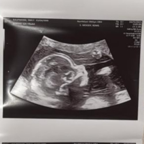 Emily Kaufmann and Julio Castro’s Baby Registry at Babylist