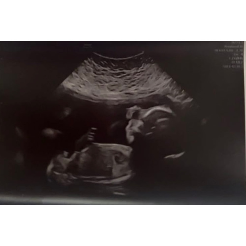 Maddox Blake