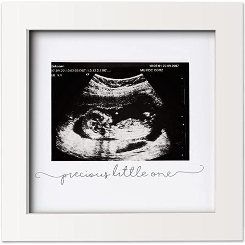 Baby Sonogram Picture Frame - Modern Ultrasound Frame for Mom to Be - Pregnancy Announcement Sonogram Photo Frames - Gender Reveal for Expecting Parents - First Time Dad Gifts (Alpine White)