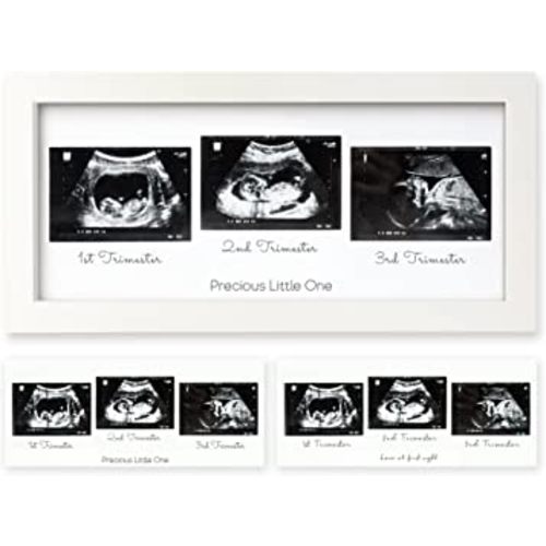 Sonogram Picture Frame - Trio Ultrasound Picture Frames For Mom To Be Gift - Baby Ultrasound frame - Pregnancy Announcements Sonogram frame - Baby Nursery Decor, Pregnant Mom Gifts(Alpine White)