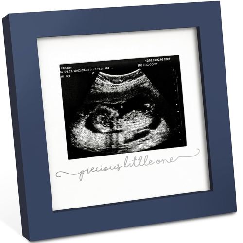 KeaBabies Baby Sonogram Picture Frame - Modern Ultrasound Picture Frames for Mom to Be, First Pregnancy Gifts for Expecting Mom, Baby Gender Reveal Gifts, Pregnancy Announcement (Midnight Blue)