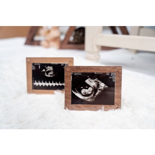 Ultrasound Photo Frame / Baby Sonogram Picture Frame - Etsy