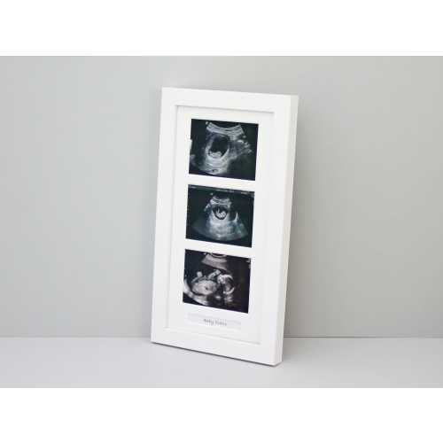 Baby Scan Photo Frame - Multi aperture Frame for Three Scan sized Photos and Text Box. Handmade. Baby Shower Gift | Pregnancy Announcement