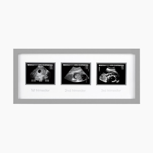 Pearhead Trimester Sonogram Frame