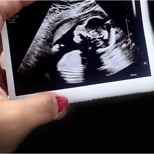 Baby Escobedo cash fund