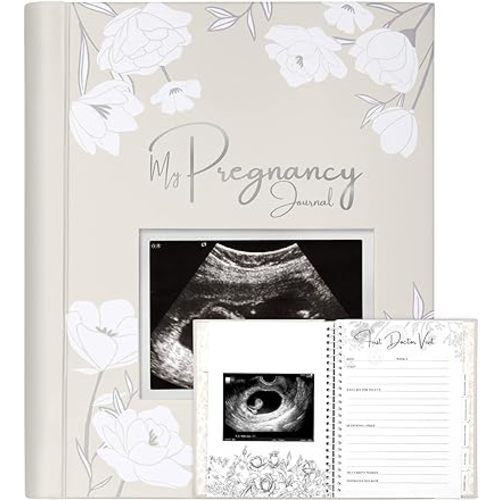 Pregnancy Journal, Pregnancy Announcements - 80 Pages Hard Cover Pregnancy Book For Mom To Be Gift - Pregnancy Gifts For New Moms - First Time Expecting Mom Gift - Baby Album And Memory Book (Clay)