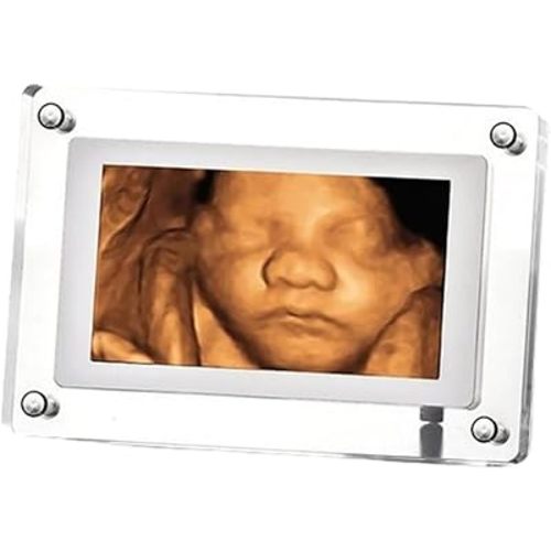 MBHB Digital Picture Frame, 7” Screen, Electronic Photo Frames for Ultrasound Replay, Re-chargeable 4GB Memory, USB Charging, Vertical/Horizontal Display, Upload Photos/Videos Easily