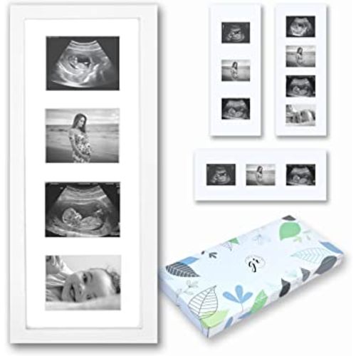 Baby Sonogram Picture Frame | 3 in 1 Layout Set, White | Ultrasound Frame | Vertical or Horizontal | Baby Ultrasound Picture Frame | Ultrasound Picture Frames | Sonogram Frame | Ultrasound Photo Frame | Ultrasound Frames for Baby