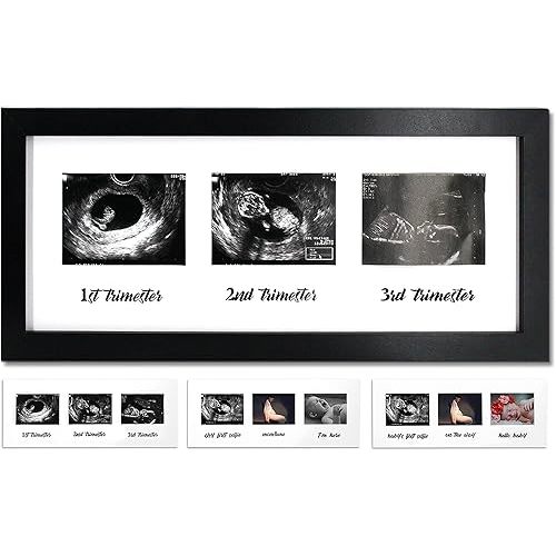 IHEIPYE Triple Sonogram Pregnancy Frame – Baby Ultrasound Picture Frame with Story for Expecting Parents, Baby Shower Frame, Baby Grow Through All Three Trimesters Frame, Nursery Decor, Black