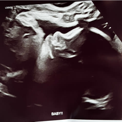 Newborn Photos
