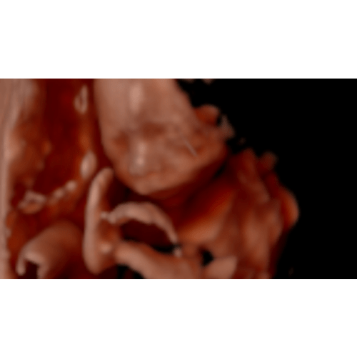 Fundraiser by Kaliah Watts : Donations Needed for Cloth Diaper Service