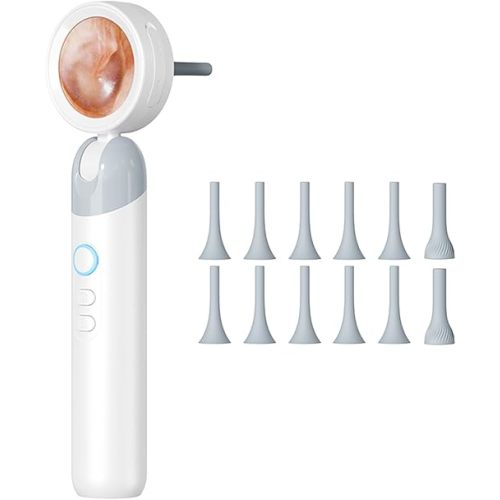 Ear Camera with 1.21” Screen, 1080P HD Digital Otoscope Ear Scope with 4 LED Lights, Skin Inspection Probe, 10 Ear & Nose Tips, 6 Ear Pick Tools, for Adults Kids Pets, Type-C Charging (White)