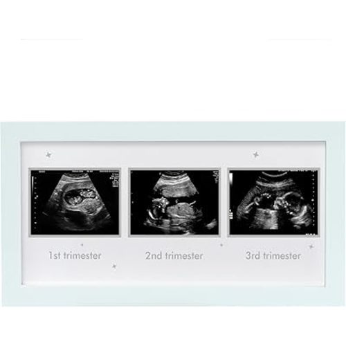 Ultrasound Picture Frame - Triple Sonogram Frame for Mom to Be | Pregnancy Photo Album Decor | Baby Nursery Essentials & Gender Reveal Gifts | First Trimester Keepsake & Pregnancy Must Haves - White1