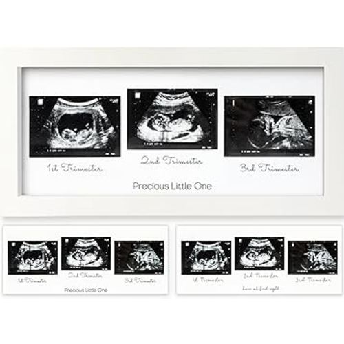 KeaBabies Baby Sonogram Picture Frames - Trio Ultrasound Picture Frames, First Time Mom Gift, Cute Pregnancy Reveal Photo Frame, Baby Gender Reveal Gift, Newborn Nursery Decor (Alpine White)