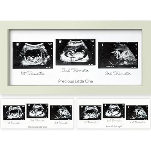 KeaBabies Sonogram Picture Frame - Trio Ultrasound Picture Frames For Mom To Be Gift - Baby Ultrasound frame - Pregnancy Announcements Sonogram frame - Baby Nursery Decor, Pregnant Mom Gifts (Sage)
