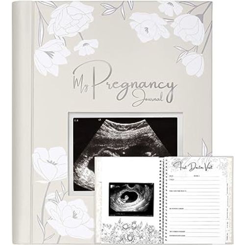 Pregnancy Journal, Pregnancy Announcements - 80 Pages Hard Cover Pregnancy Book For Mom To Be Gift - Pregnancy Gifts For New Moms - First Time Expecting Mom Gift - Baby Album And Memory Book (Clay)
