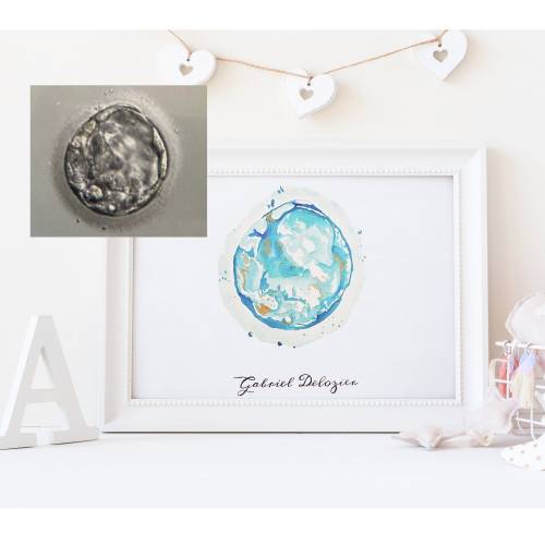 Custom Embryo Art - Nursery - Baby Shower Gift - New Baby - IVF - Embryo - Watercolor - Baby Gift - Nursery Decor -