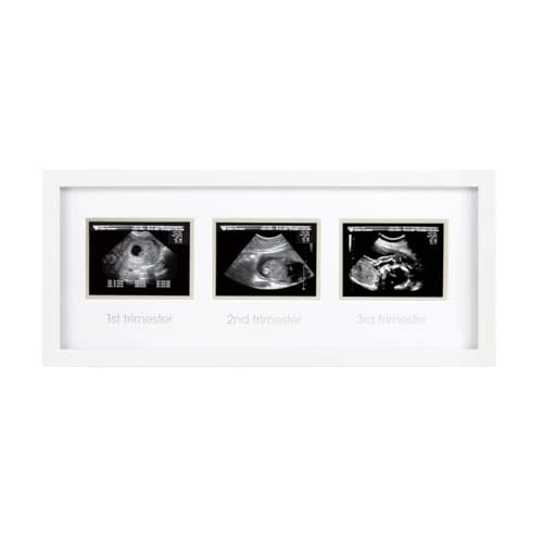 Pearhead Sonogram Progression Frame - Trimester by Trimester Pregnancy Milestone Keepsake, Gender-Neutral Nursery Decor, Displays 1st, 2nd & 3rd Trimester Ultrasound Photos, White