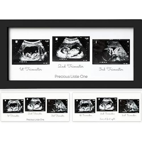 Sonogram Picture Frame - Trio Ultrasound Picture Frames For Mom To Be Gift - Baby Ultrasound frame - Pregnancy Announcements Sonogram frame - Baby Nursery Decor, Pregnant Mom Gifts (Onyx Black)