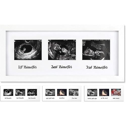 IHEIPYE Triple Sonogram Pregnancy Frame - Baby Ultrasound Picture Frame for Expecting Parents, Baby Shower Frame, Gender Reveal Party, Baby Nursery Decor, White