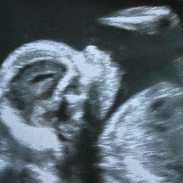 Babylist Registry Photo.
