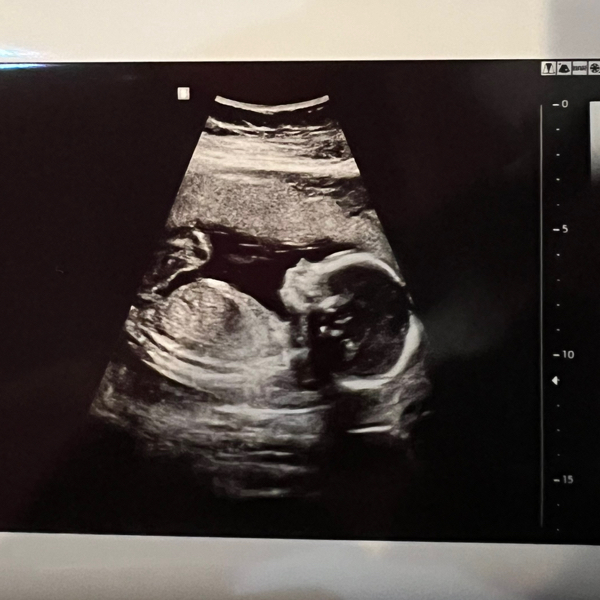 Babylist Registry Photo.