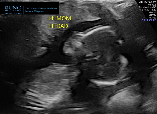 Babylist Registry Photo.