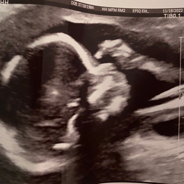 Babylist Registry Photo.