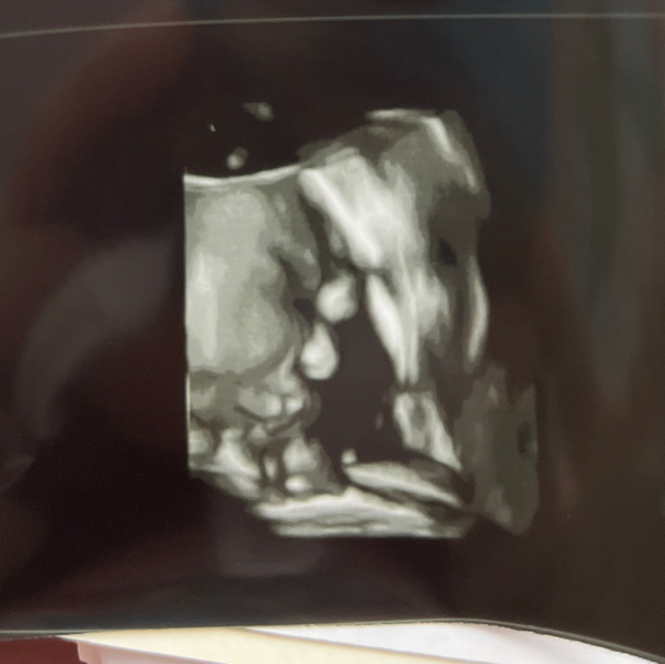 Babylist Registry Photo.