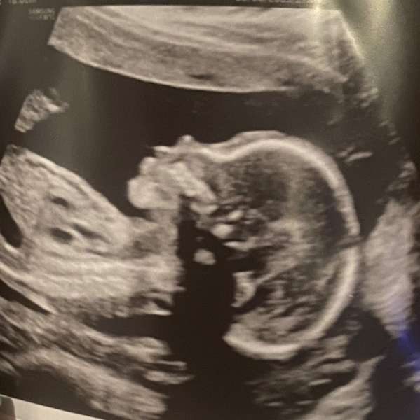 Babylist Registry Photo.