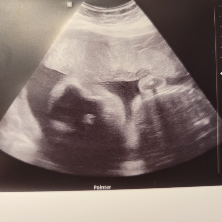 Babylist Registry Photo.