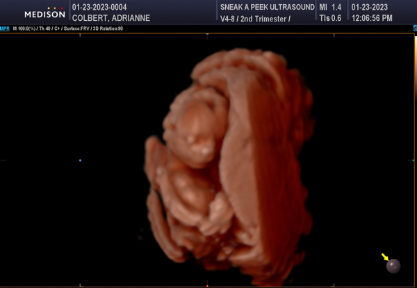 Babylist Registry Photo.