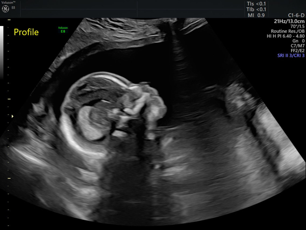 Babylist Registry Photo.
