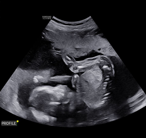 Babylist Registry Photo.