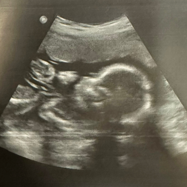 Babylist Registry Photo.