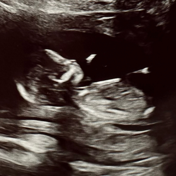Babylist Registry Photo.