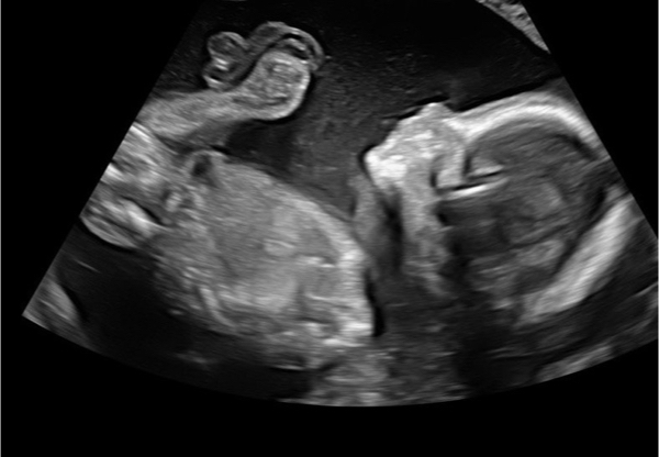 Babylist Registry Photo.