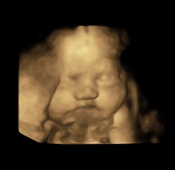 Babylist Registry Photo.