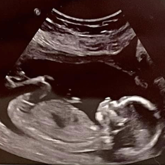 Babylist Registry Photo.