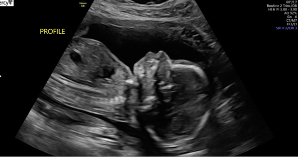 Babylist Registry Photo.