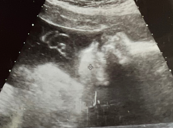 Babylist Registry Photo.