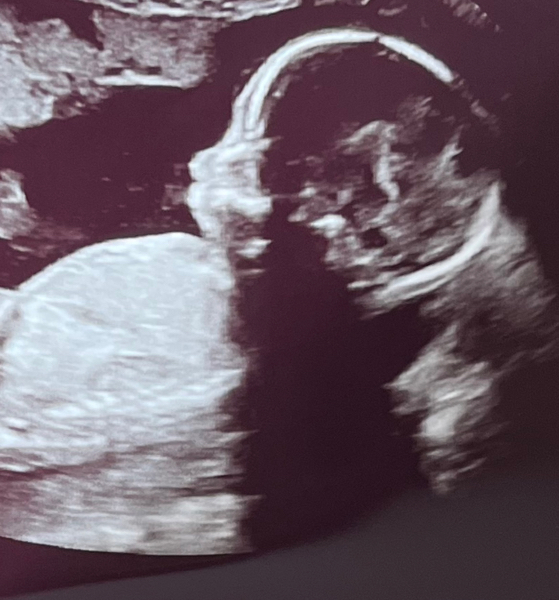 Babylist Registry Photo.