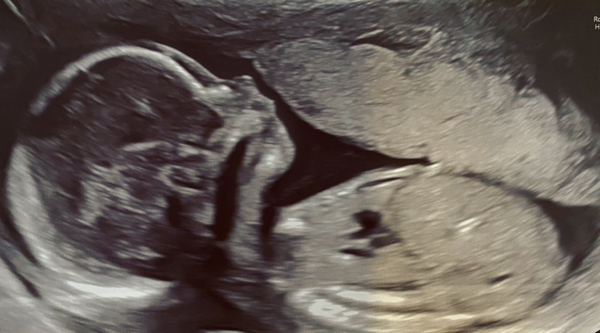 Babylist Registry Photo.