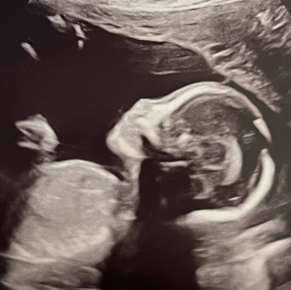 Babylist Registry Photo.