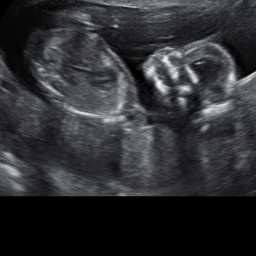 Babylist Registry Photo.