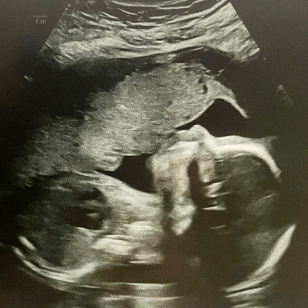 Babylist Registry Photo.