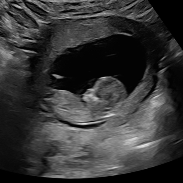 Babylist Registry Photo.