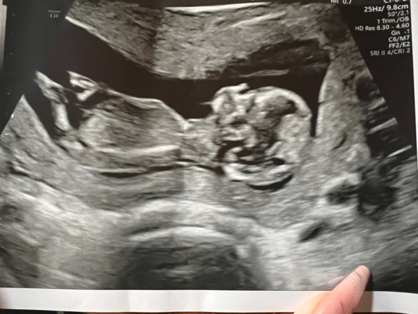 Babylist Registry Photo.